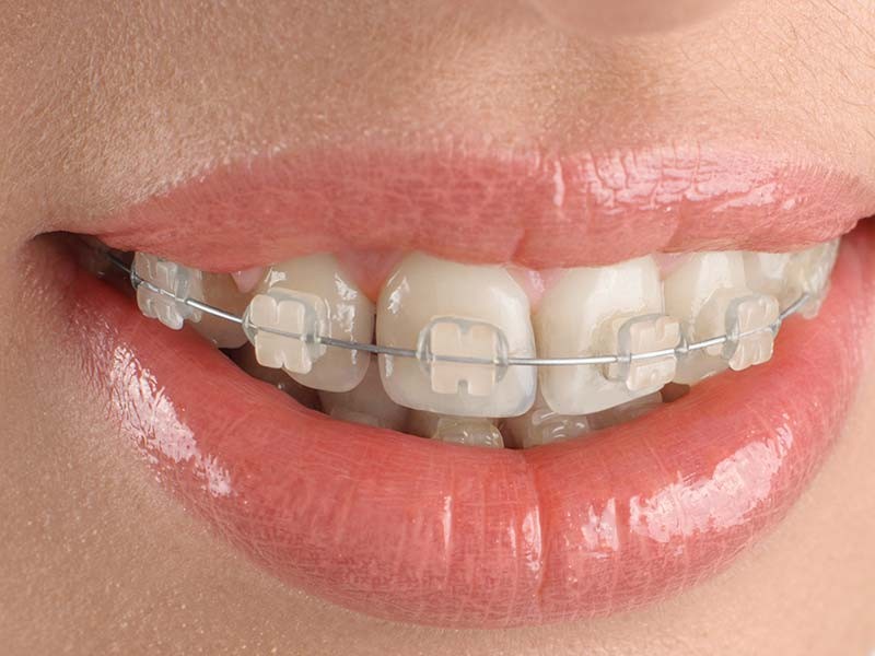 Digital Innovation in Dentistry: How 3D Imaging Is Redefining the Orthodontist’s Role