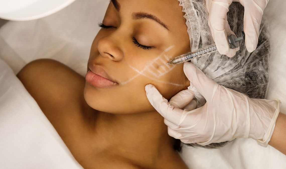 Hyaluronic Acid Fillers Explained for People Who Are Nervous About Needles