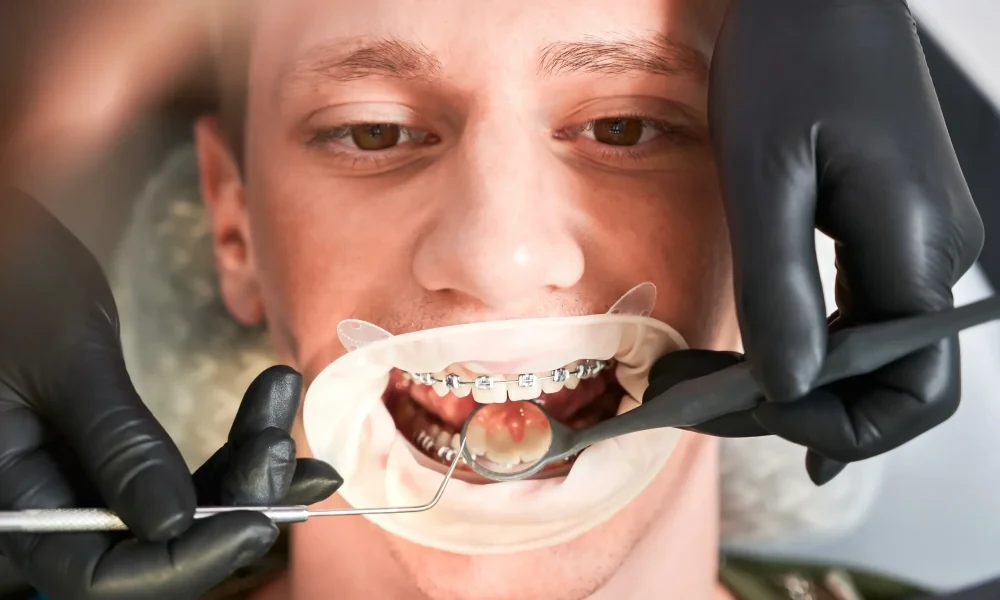 Emergency Dental Services From A Dentist In Anchorage AK For Urgent Care